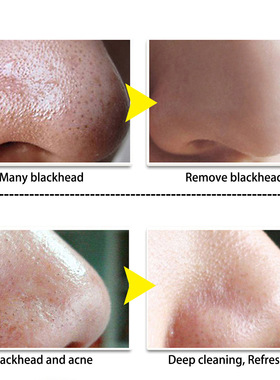 NoseMaskBlackhdRemov