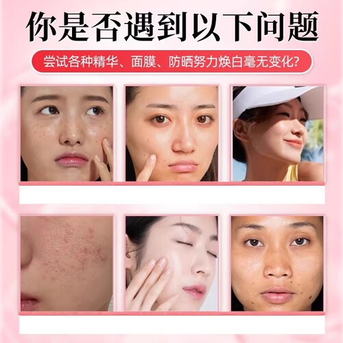 北京同仁堂御医匠维生素C维生素E烟酰胺葡萄籽胶原蛋白片黄黑皮 - 图0