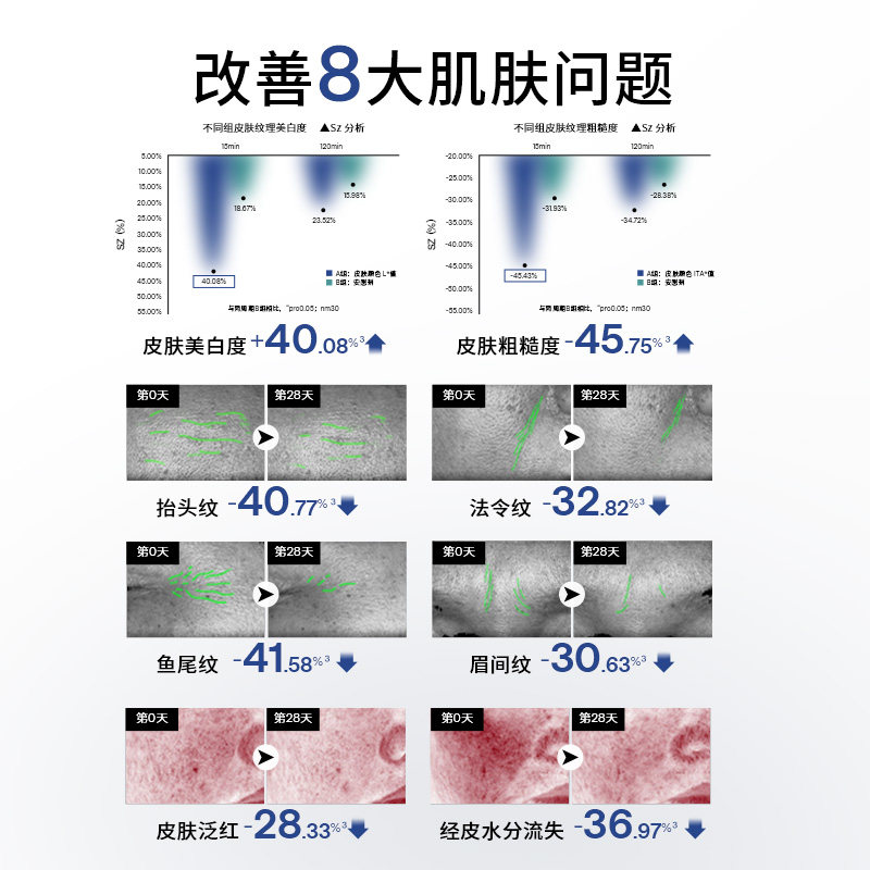 【老爸抽检】Ulike超光炮牛奶光美容仪面部淡痘美白光子嫩肤仪器