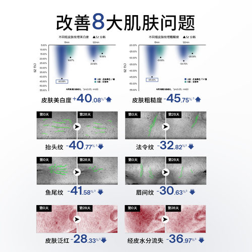 Ulike童颜超光炮美容仪水光仪脸部家用嫩肤仪光子嫩肤美白紧致 - 图1