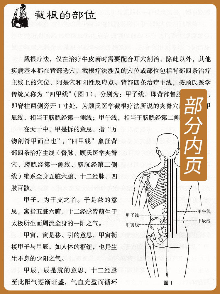 正版现货 截根疗法 濒临失传的中医绝技如癌症肿瘤 李保平 中医书籍大全 中医内科外科五官科肿瘤妇科疾病诊治 中医医案治疑难杂症 - 图0