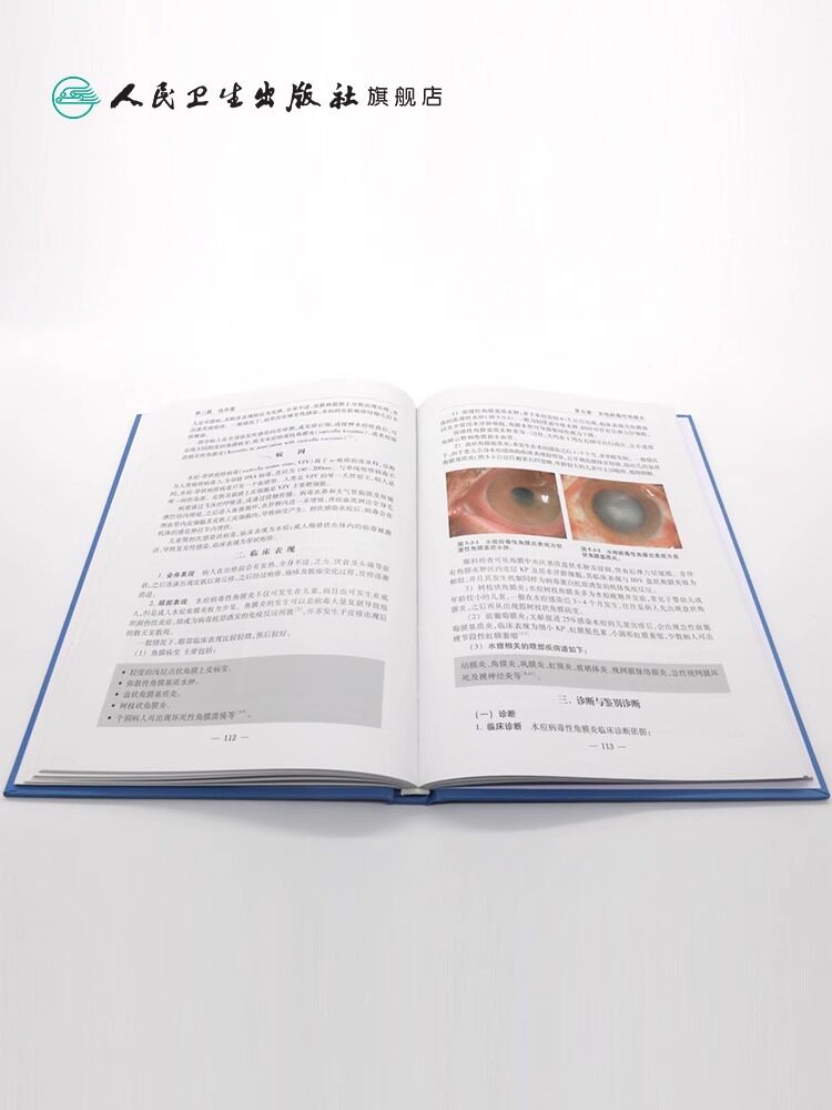 正版 抗精神病药的严重副作用 杨甫德主译 药学精神病学临床药学药物严重副作用不良反应 人民卫生出版社