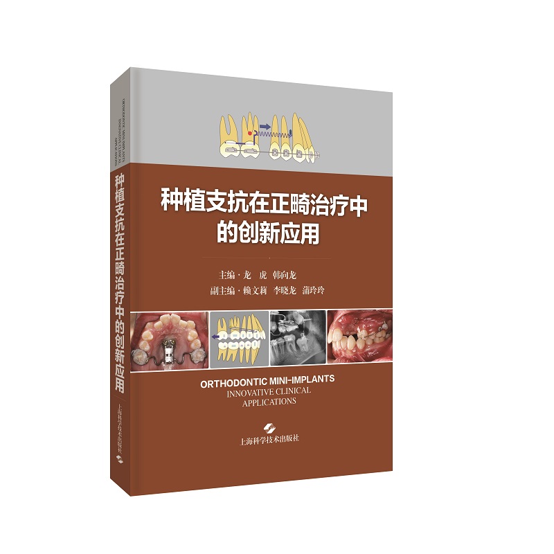 种植支抗在正畸治疗中的创新应用 临床口腔科学 图文并茂阐述种植支抗植入步骤和植入技巧的专著 龙虎 韩向龙 上海科学技术出版社 - 图3