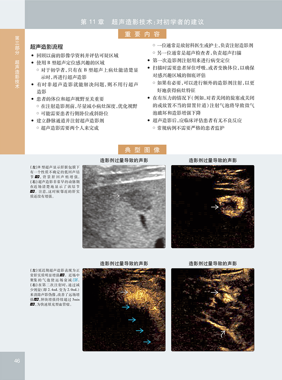 超声造影显像技术要点与临床应用详细阐述了增强超声的技术建议和影像学描述标准用语配有说明注释卢强彭成忠赵博人民卫生出版社-图1