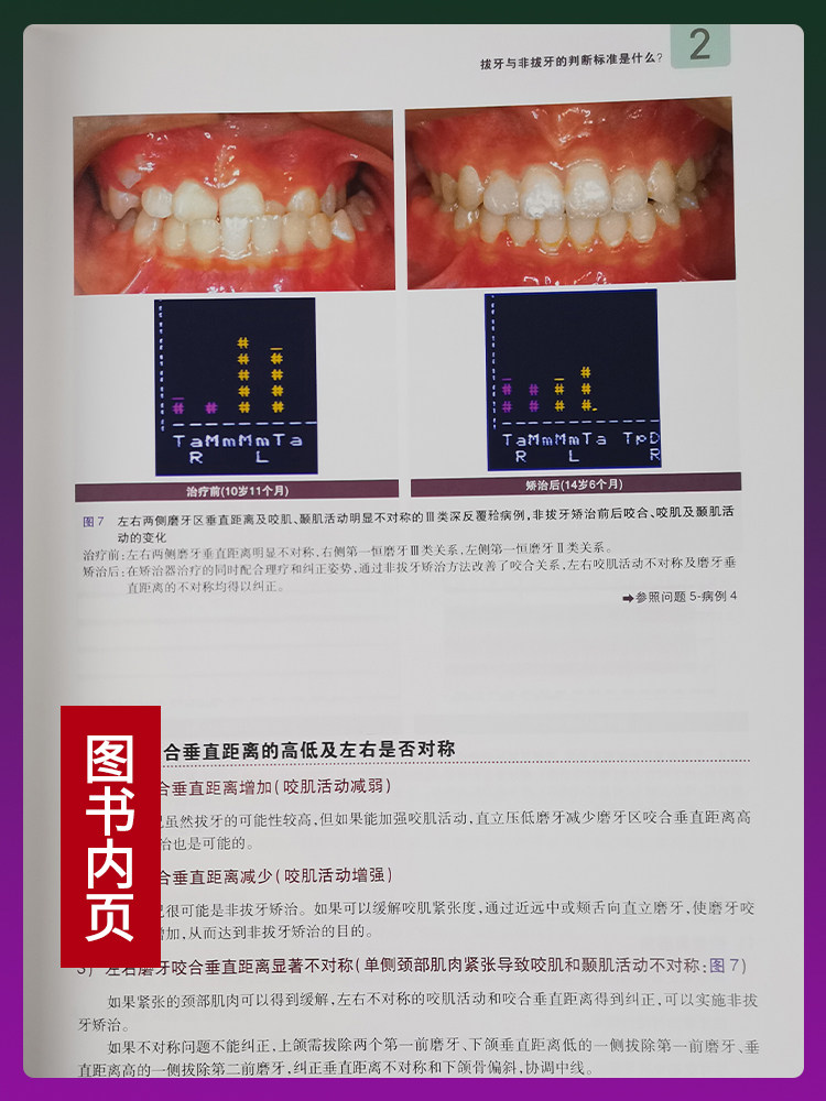 现货muscle Wins正畸临床矫治疑难问题及病例解析 日 近藤悦子著白玉兴杨力赵弘译口腔科学生活图书籍人民卫生出版社