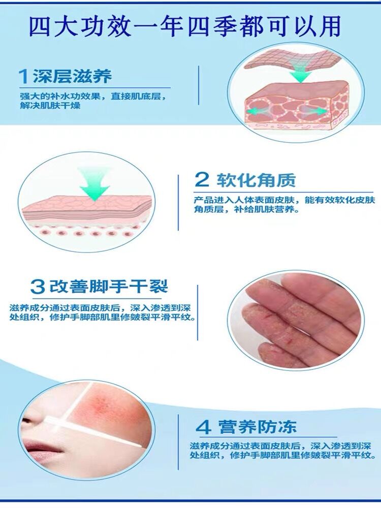 奥姿裂可宁霜100G组合瓶护手霜护足霜手脚脸干裂保湿滋润不粘不腻