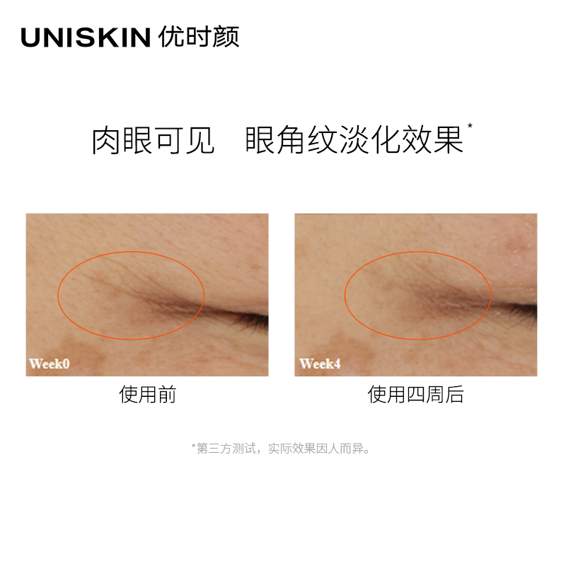 uniskin优时颜微笑眼霜淡化黑眼圈眼袋细纹抗皱紧致提亮官方正品 - 图1