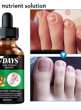 Nail Fungus Treatment Essence Serum Care Hand and Foot Care