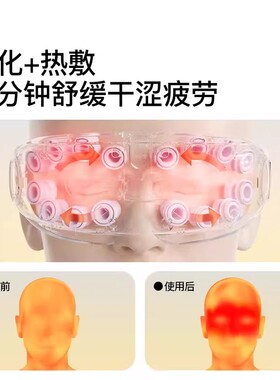 PGG眼部按摩仪E4pro护眼仪润眼缓解眼疲劳干眼症干涩雾化热敷蒸汽