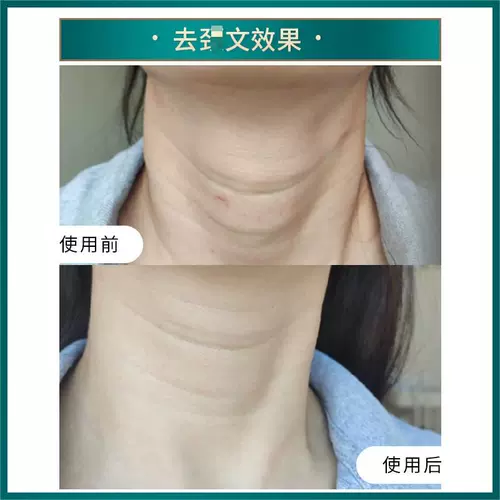 Японский осветляющий подтягивающий крем для шеи, против морщин