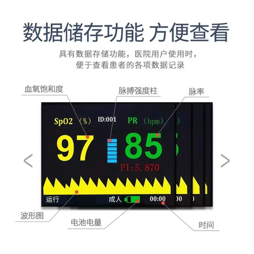 Как кровь -кислородный прибор для новорожденного модельный пульс крови кислород -прибор для дома пульс мониторинг пульса импульсы инструмент мониторинга Медицинский