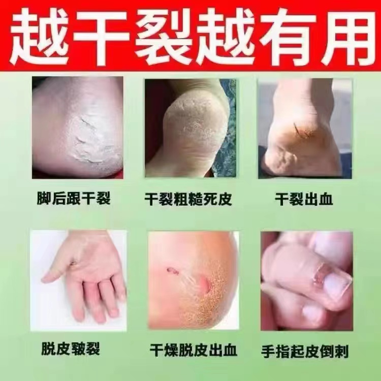 [拍2發3]裂可寧防干裂護手霜腳后跟防裂防凍手足滋潤保濕男女正品_修福堂醫療器械專營店_保健用品