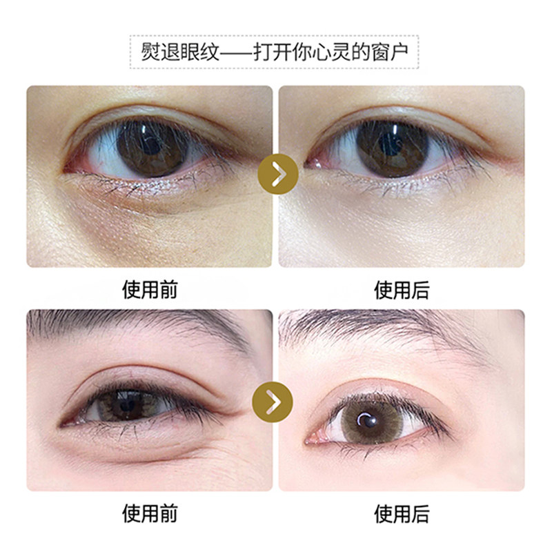 抖音同款燕窝酵母精华正品眼膜贴 purzeal朴致化妆品眼膜