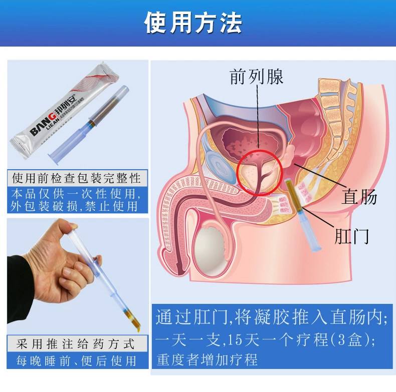 邦列安前列腺炎慢性治疗抗菌凝胶 多芬爱医疗器械保健理疗