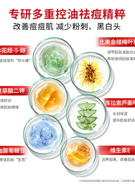 娇本祛痘护肤品套装保湿补水