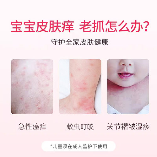 炉甘石洗剂婴儿洗液涂剂皮炎湿疹皮肤快速止痒寻荨麻疹瘙痒药水H - 图2
