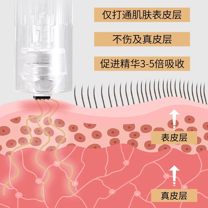 西德瑞 [头皮充电纳米促吸收男女生头发微针中胚层导入电动微晶仪]