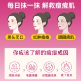 Крем ретиноевой кислоты для медицинского крема из изотретиновой кислоты Официальный флагманский магазин ретиноевой кислоты крем для латекса против крема ретиноевой кислоты