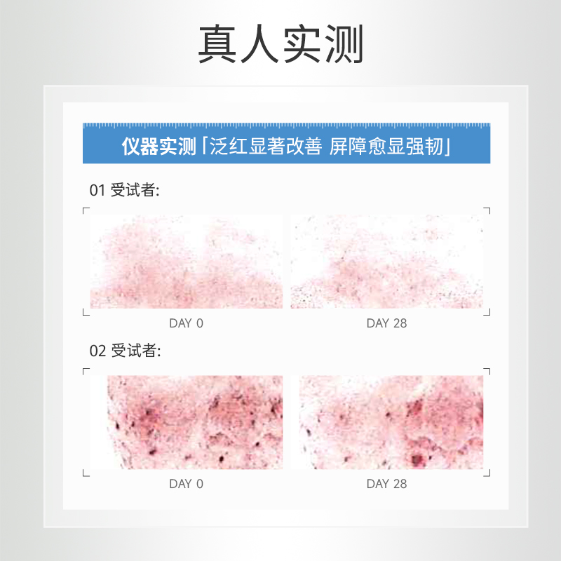 益肤纳米面膜微分子透明质酸钠舒敏修护面膜修护褪红补水保湿