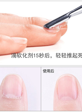 BlueCross美国去死皮软化剂
