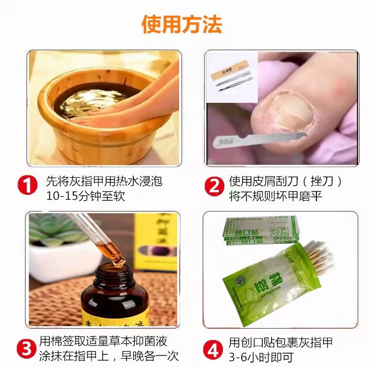 2送1/ 3送2伊喜畅护理液灰指液 慧欧保健品保健理疗