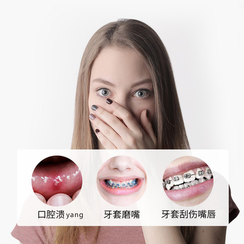 日本gum 正畸保护蜡贴牙齿支抗钉骨钉牙套蜡矫正钢牙套粘膜防磨嘴 - 图0