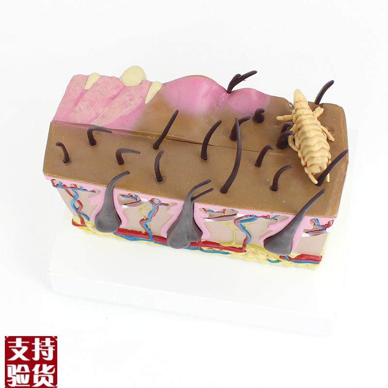 ENOVO颐诺狗k皮肤模型犬跳蚤咬伤犬皮肤宠物狗皮肤解剖模型犬皮,淘宝优惠券,粉丝福利购,淘宝优惠卷