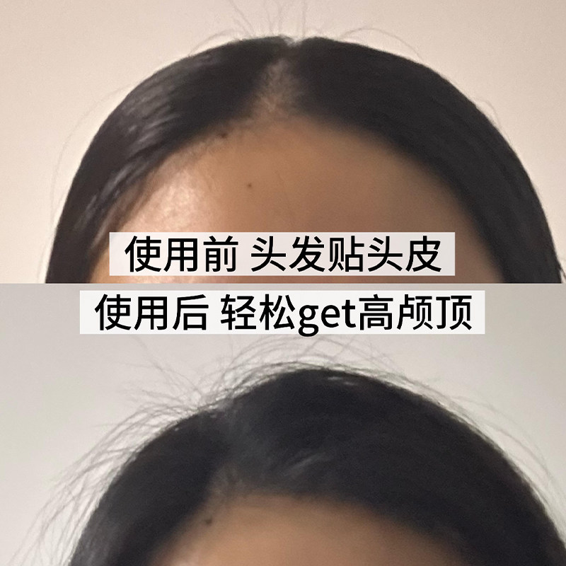 即沐蓬蓬免洗洗发水嘭嘭玻尿酸敏感肌可用控油高颅顶免洗福瑞达,淘宝优惠券,粉丝福利购,淘宝优惠卷