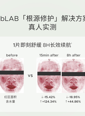 【立即付定】Bblab苾莱宝B5复活肽面膜保湿淡纹紧致熬夜急救滋养