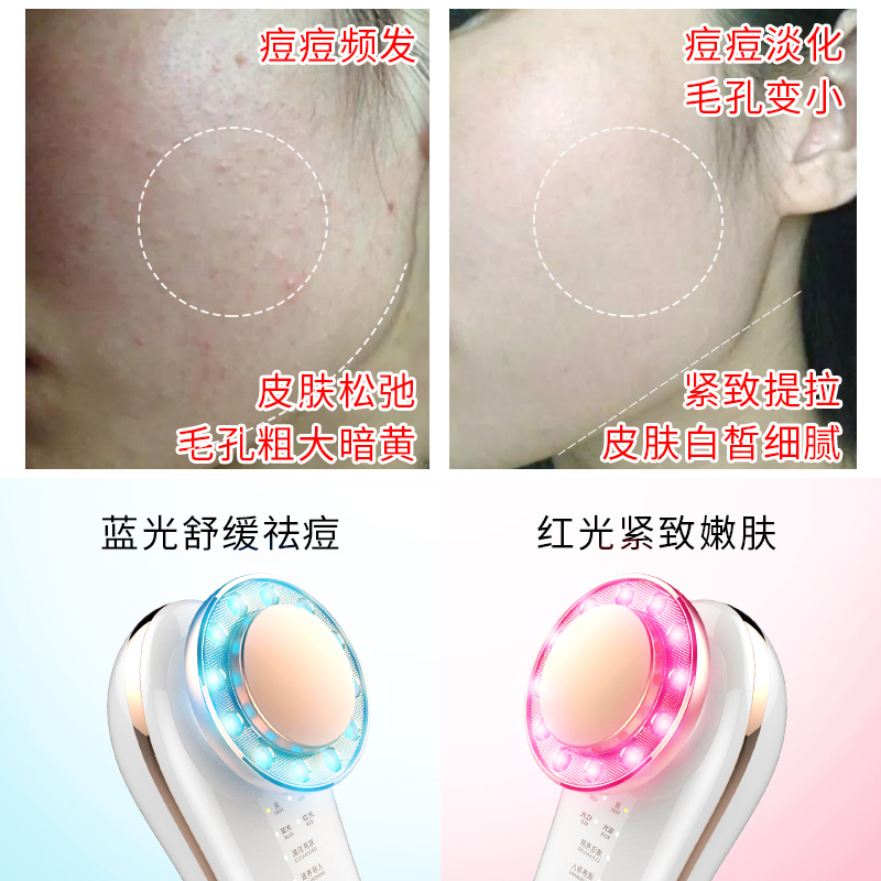 magitech美技旗舰店李佳琪美技美容仪李嘉琦推荐的毛孔家用洗脸清洁面脸部导入仪器1