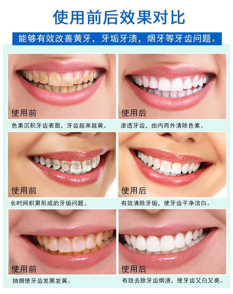 牙得安去牙渍黄牙亮白牙齿15g牙粉 牙得安牙粉