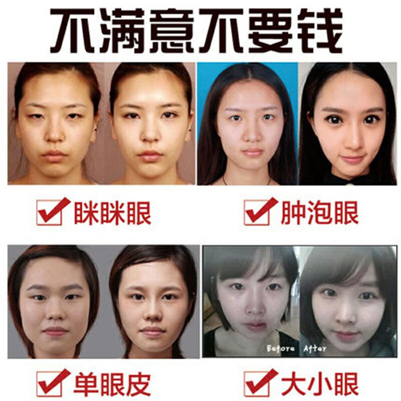 扩眼精油女开眼角精华液单眼皮变双眼皮神器小眼睛变大去肿泡眼男