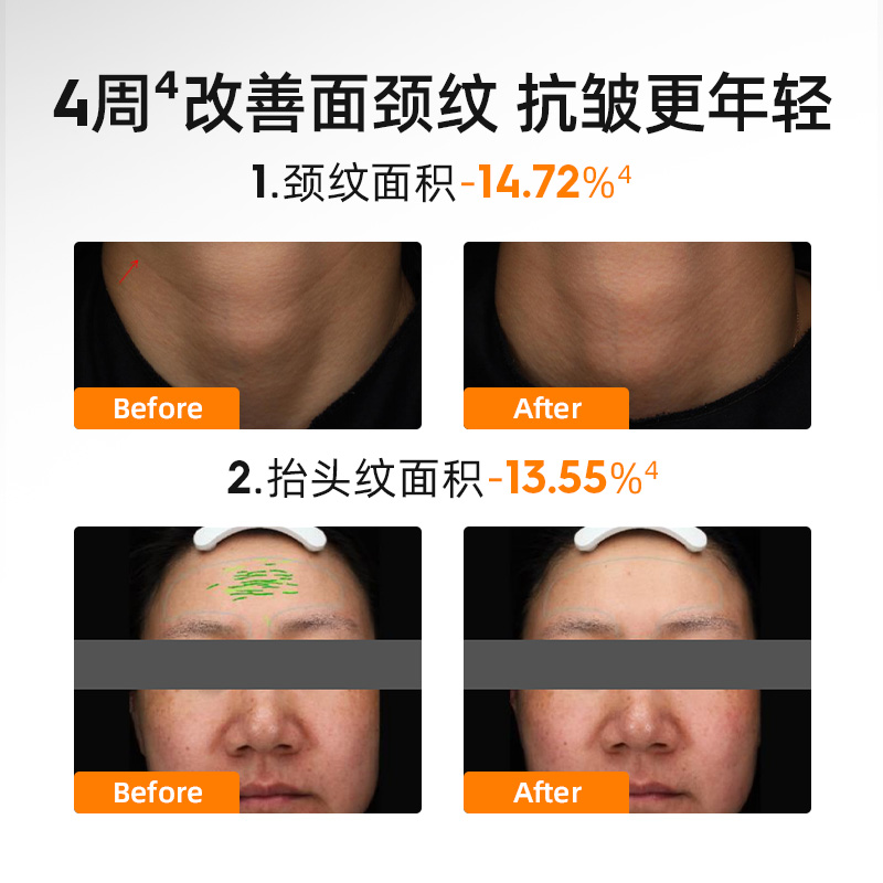 绽媄娅丰盈紧致淡纹贴骨pro面霜滋润保湿抗皱舒缓精华霜敏感肌女