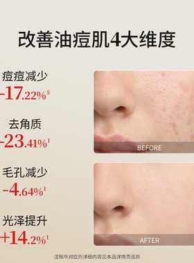 【预售付定加赠】百植萃5.7%复合果酸面膜水杨酸去角质控油祛痘