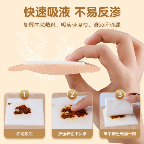 Медицинские стерильные пятна анти-кровать, пятна от язвы, пенопластовые заправки, способность лечить и пожилые ягодицы, пятна с снятия давления, защитные пластыри