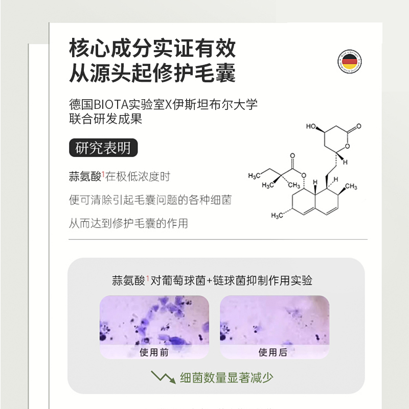 德国BIOBLAS大蒜洗发水毛囊脂溢性头皮除螨炎去屑止痒控油蓬松