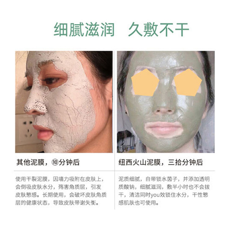 香秀的美妆店纽西之谜膜祛痘火山泥 香秀的美妆店贴片面膜