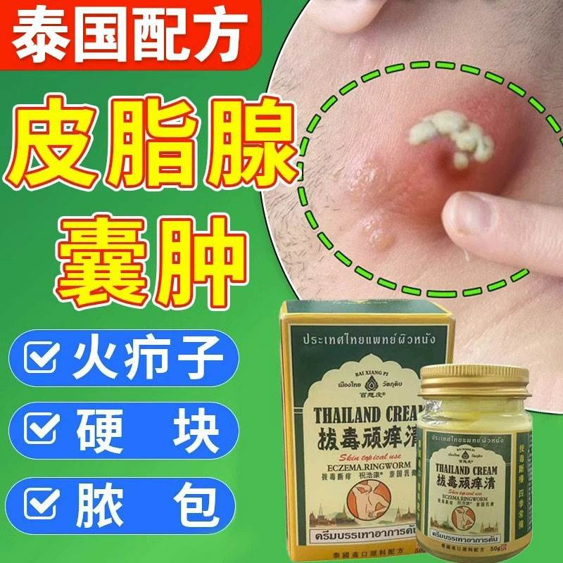 泰国疖肿拔毒膏皮脂腺囊肿火疖子药膏粉瘤去除拔脓贴长痘痘坐疮包 - 图0