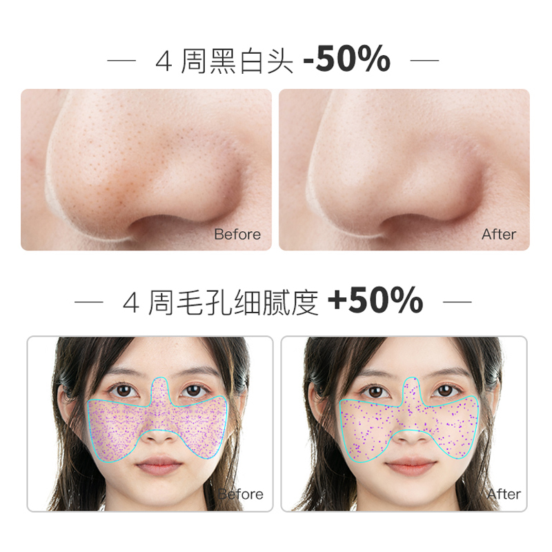 天猫国际进口超市【正品自营】EIIO清洁面膜泥膜深层清洁去黑头粉刺涂抹式白泥膜3