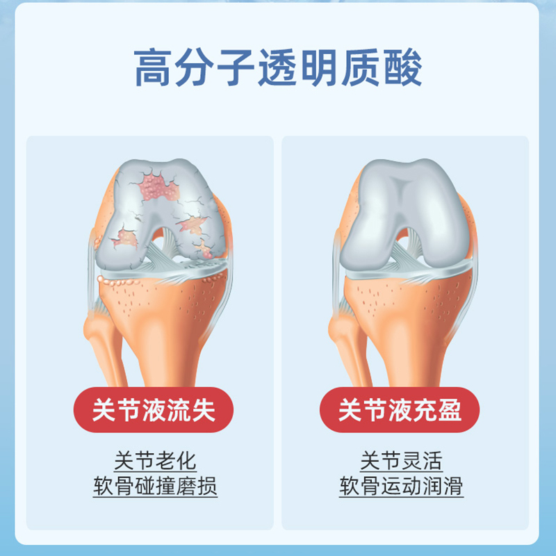 【自营】epaplus西班牙进口关节按摩膏外用氨糖涂抹运动膝盖软骨 - 图1