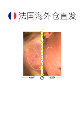 欧洲直邮Garancia格蕾森净化抗痘膏清洁膏150ml/瓶 净化排毒正品