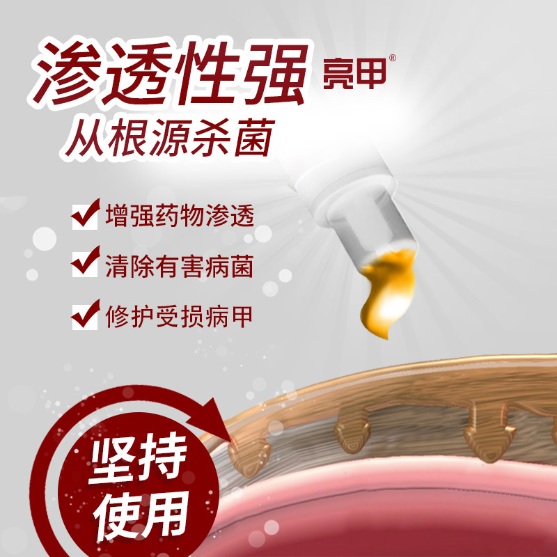 疗程3盒亮甲官网正品灰指甲甲癣液 亮甲癣症