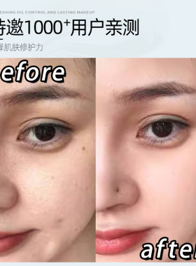99%芦荟丨男士专研丨祛痘淡印