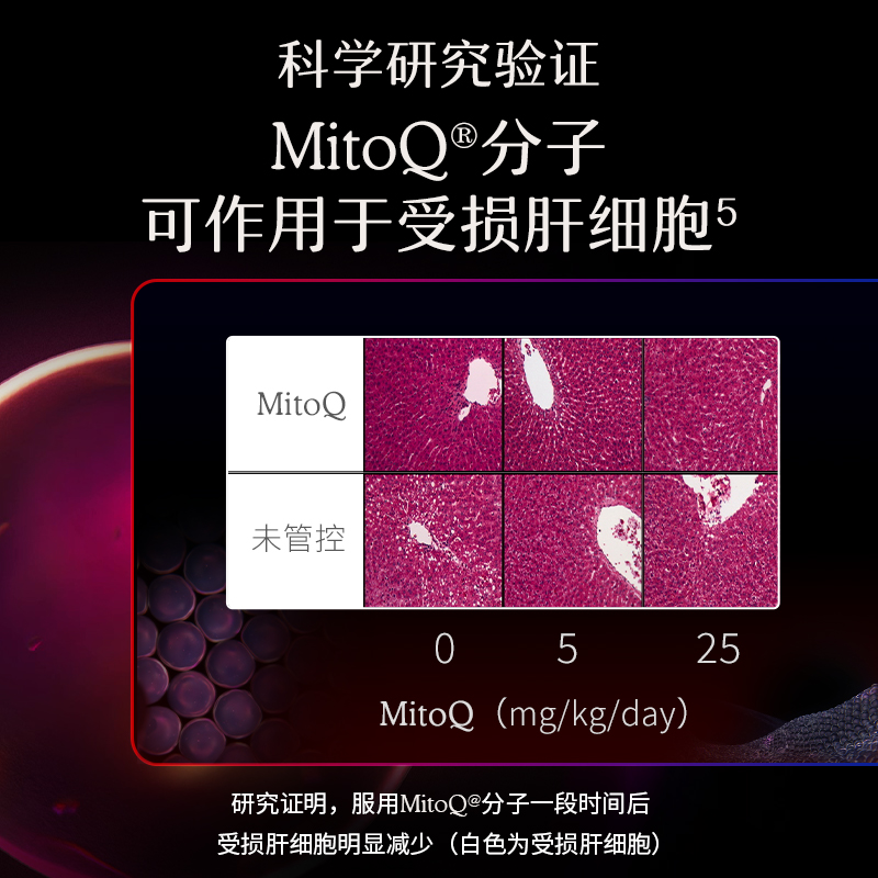 MitoQ进口护肝奶蓟水飞蓟胆碱q10熬夜加班喝酒60粒进口保健品-图2