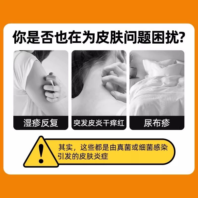 仁和曲安奈德益康唑乳膏正品皮炎湿疹止痒真菌感染专用药膏软29g,淘宝优惠券,粉丝福利购,淘宝优惠卷