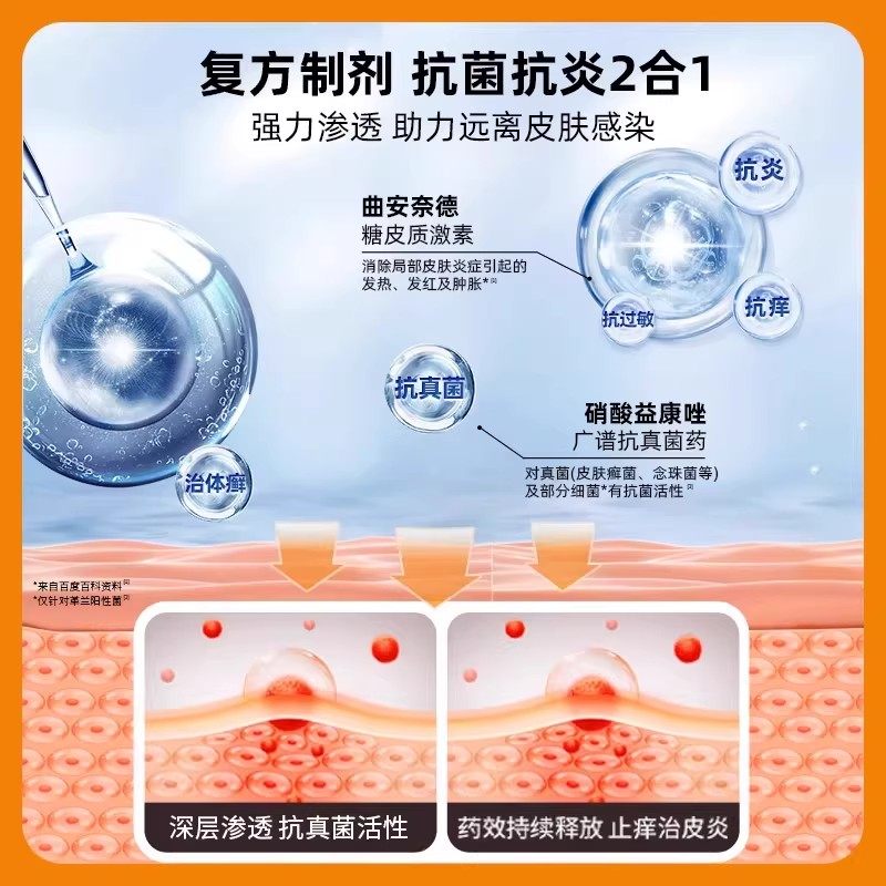 仁和曲安奈德益康唑乳膏正品皮炎湿疹止痒真菌感染专用药膏软29g,淘宝优惠券,粉丝福利购,淘宝优惠卷