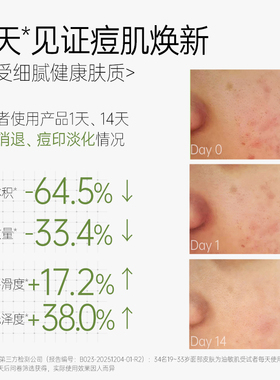 诠润控油祛痘次抛精华液