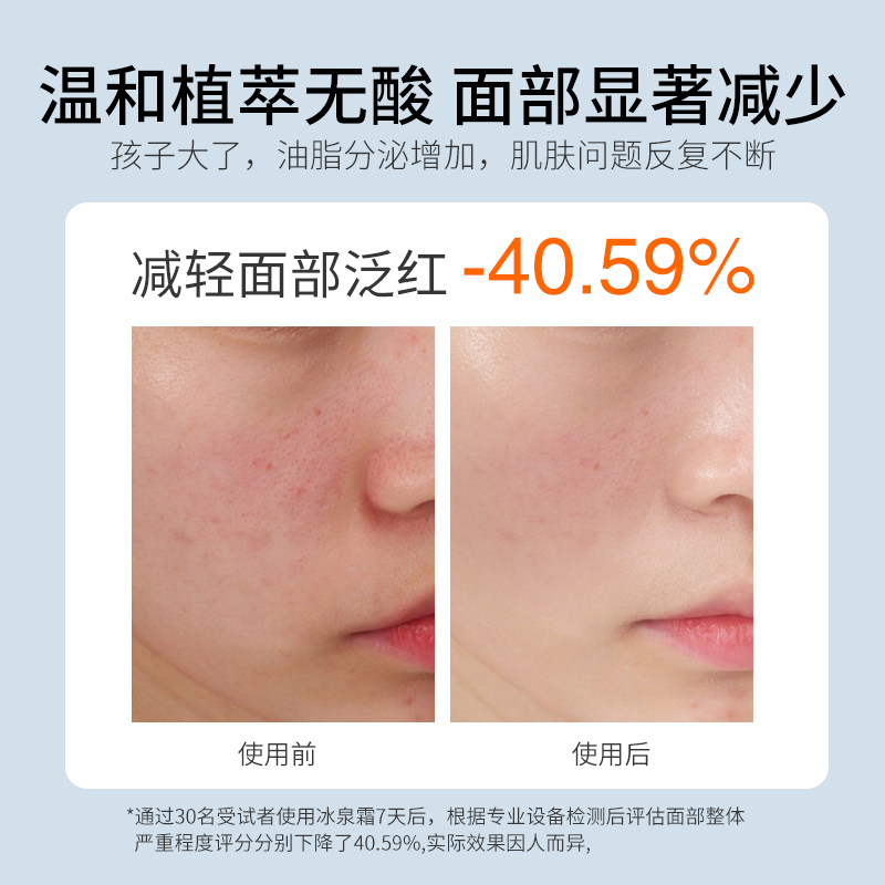 亲初青少年面霜控油儿童面霜女孩男童青春期祛痘舒缓水乳护肤套装