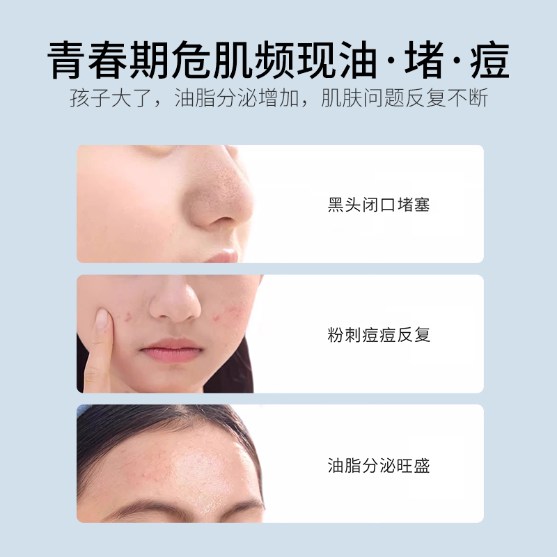 亲初青少年面霜控油儿童面霜女孩男童青春期祛痘舒缓水乳护肤套装