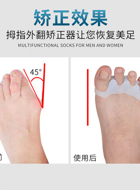 拇指外翻硅胶护理脚趾矫正器